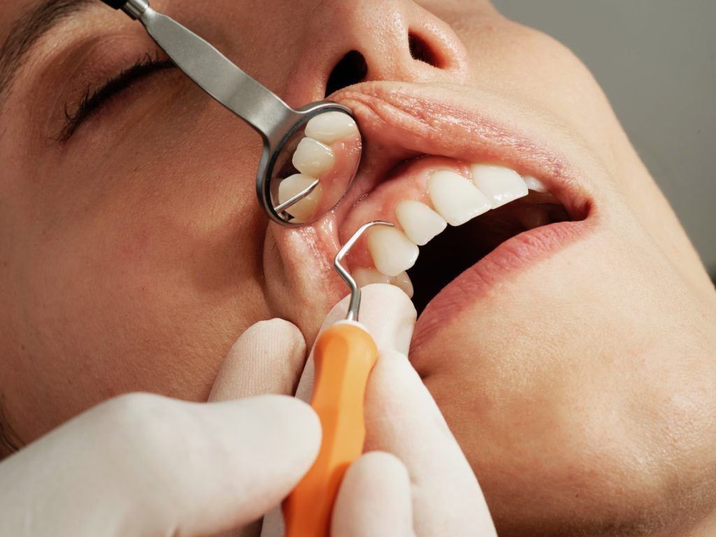 gum disease treatment Anoka MN
