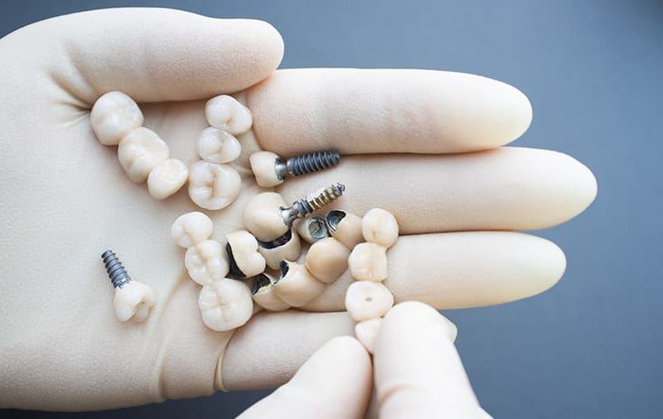 Dental Implant Restoration tools