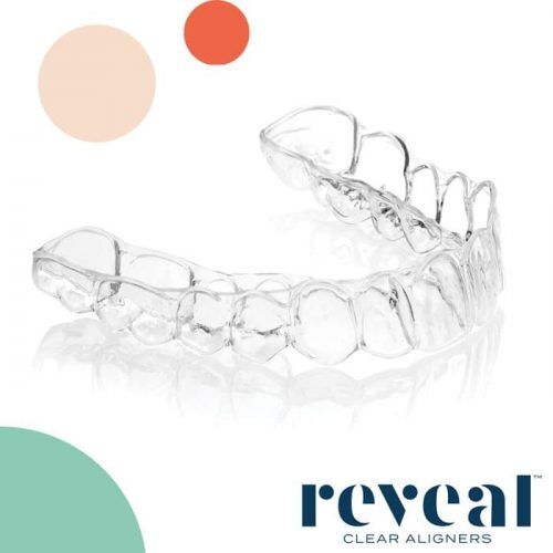 Reveal Teeth Aligners Anoka MN Reveal Teeth Aligners Anoka MN
