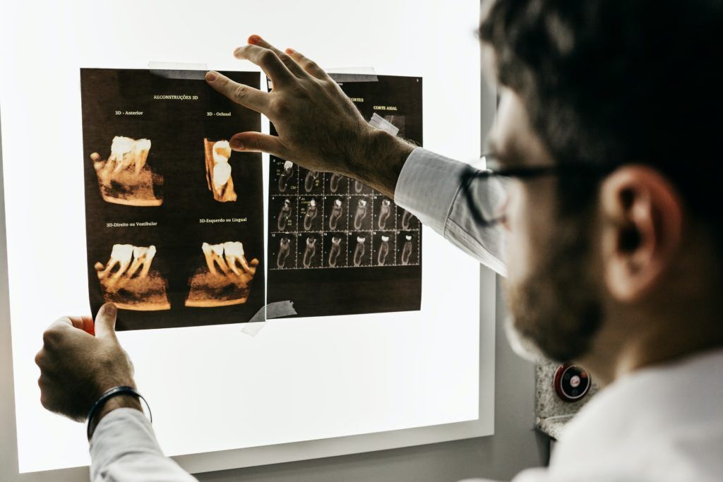 Dental X ray for tooth decay Anoka MN