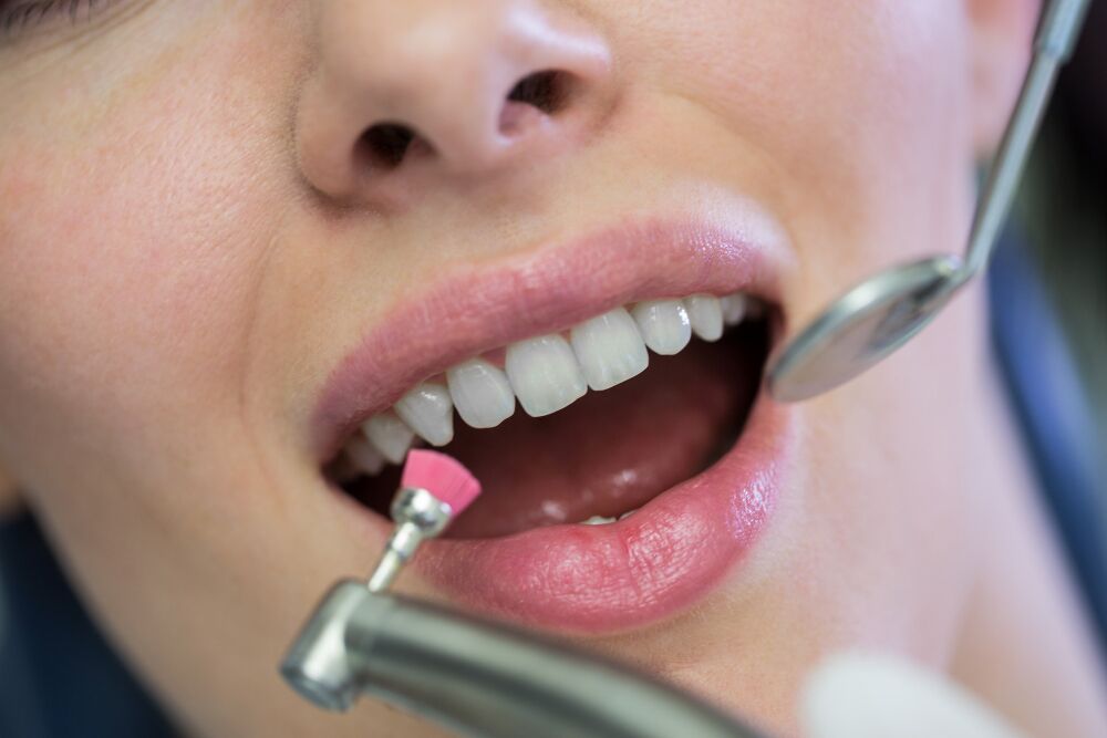 Why choosing a professional dental clinic matters